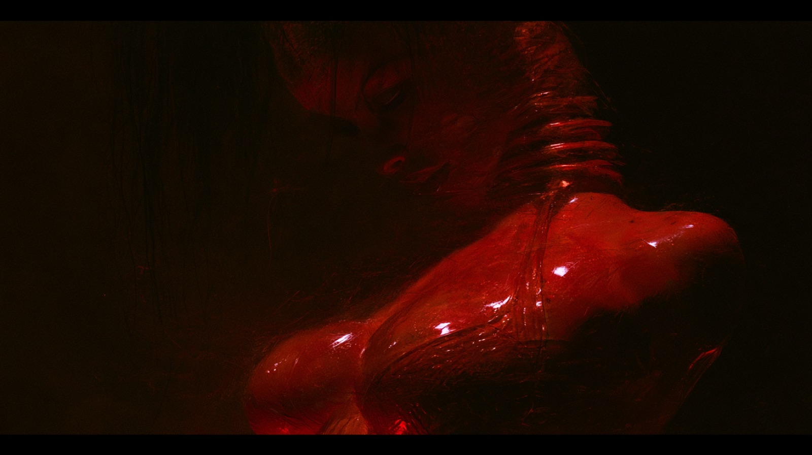 BODY 314